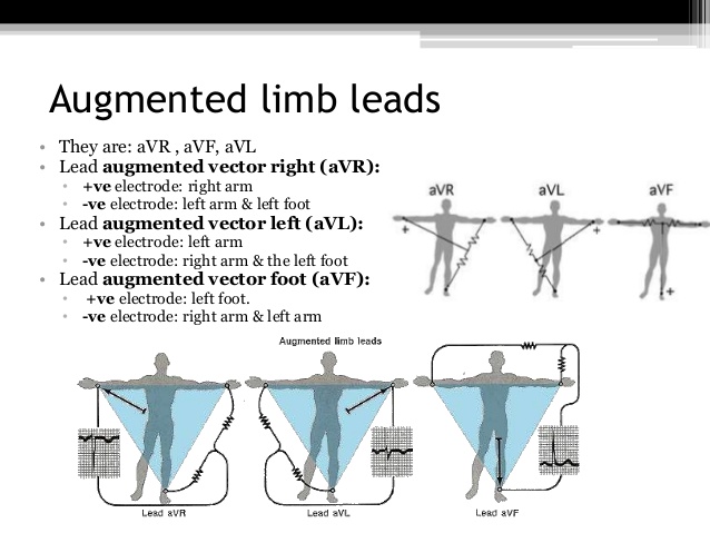 638x479 Diagnostic Investigations Of Cardiovascular System