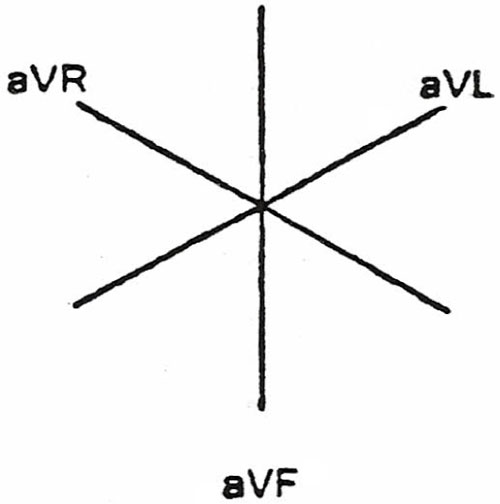 500x504 Ekg Interpretation