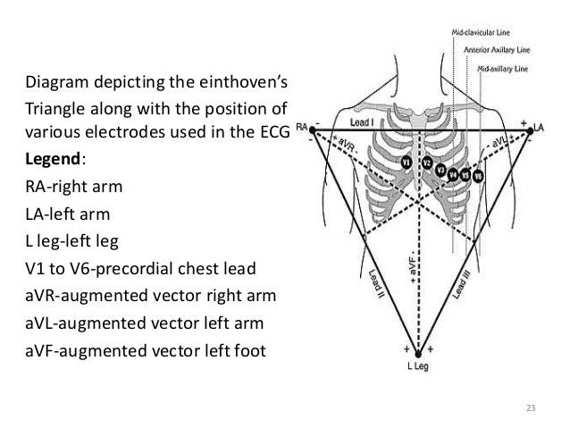 638x479 Electrocardiography