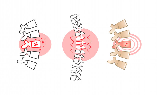 Back Pain Vector Illustration With Red Circle Vector Premium 626x381 Back Pain Vector Illustration With Red Circle Vector Premium