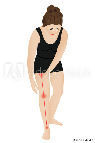 Joint Pain Sciatic Nerve Sciatic Back Pain Vector Illustration 334x500 Joint Pain Sciatic Nerve Sciatic Back Pain Vector Illustration