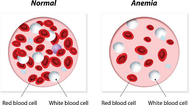 612x336 Normal And Anemic Amount Of Red Blood Cells Vector Illustration