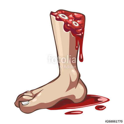 Cartoon Vector Severed Bleeding Leg With Blood Puddle Stock Image 500x500 Cartoon Vector Severed Bleeding Leg With Blood Puddle Stock Image