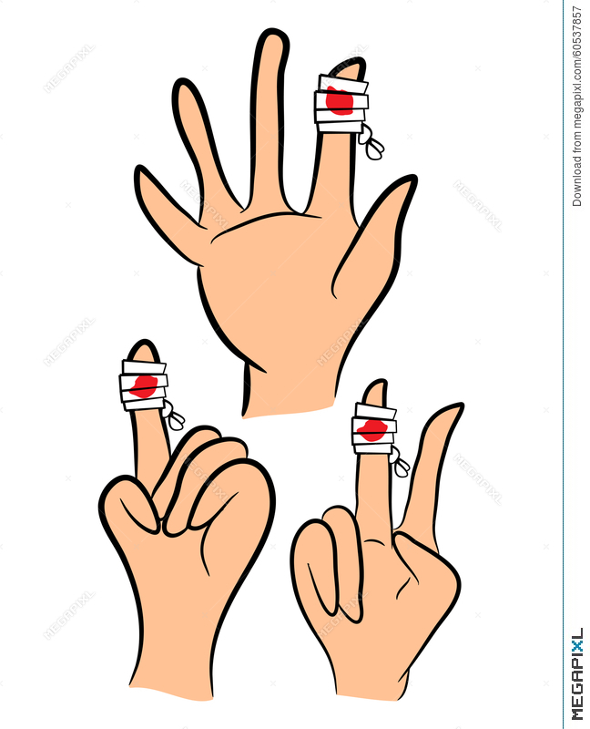 Set Of Injured Finger, Hand Wrapped In Bandage With Red Blood 648x800 Set Of Injured Finger, Hand Wrapped In Bandage With Red Blood