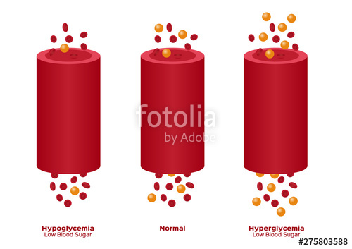 500x353 Glucose In Blood Vector Hypoglycemia, Hyperglycemia Stock Image