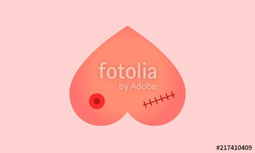 500x300 Breast Cancer Awareness Concept Breasts After Cancer Vector