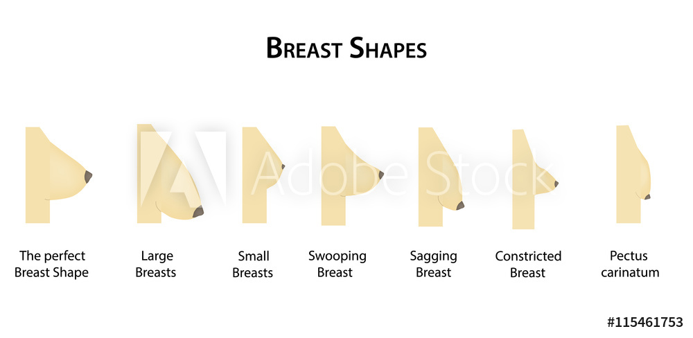 1000x488 Photo Art Print Shape The Breast Vector Illustration