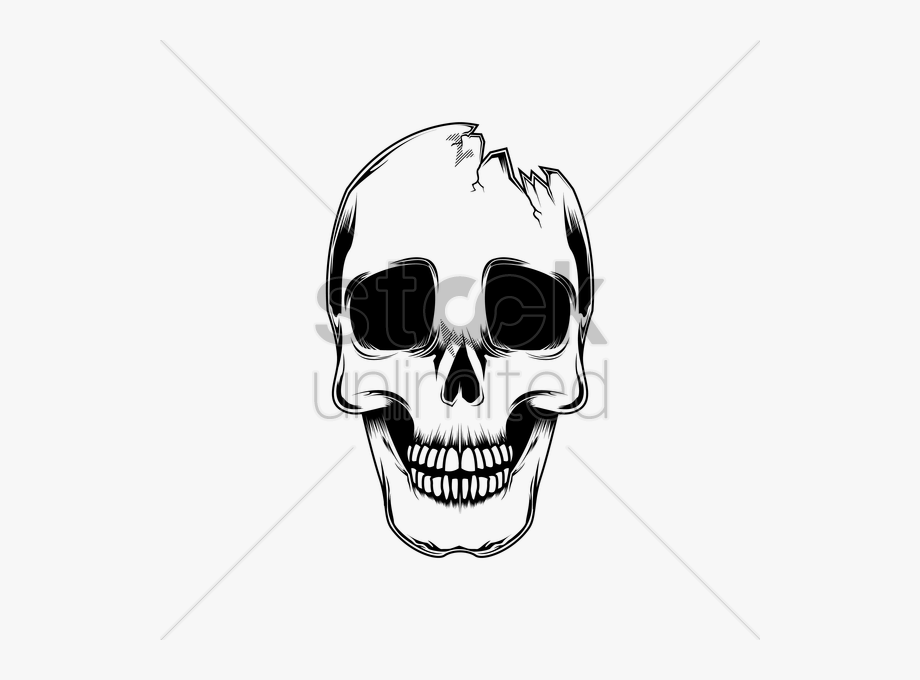 920x680 Skeleton Clipart Broken