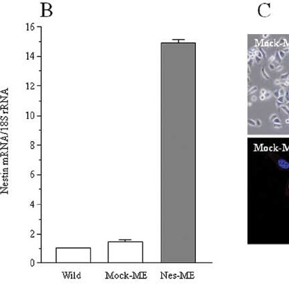 Cervical Cancer Cell Lines And Transfection Of Nestin Expression 416x416 Cervical Cancer Cell Lines And Transfection Of Nestin Expression