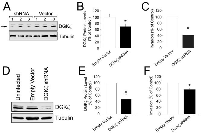 Increased Diacylglycerol Kinase Expression In Human Metastatic 685x444 Increased Diacylglycerol Kinase Expression In Human Metastatic