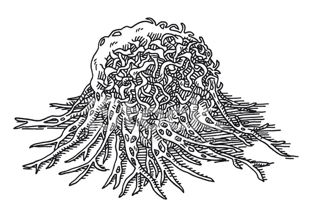 Cancer Cell Tumor Macro Drawing Stock Vector 629x440 Cancer Cell Tumor Macro Drawing Stock Vector