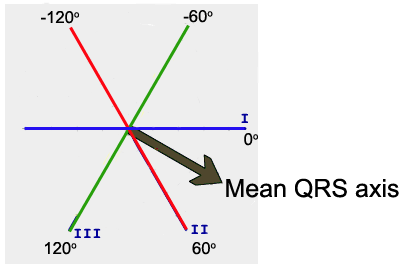 Cardiovascular Lab Electrocardiogram Basics 406x268 Cardiovascular Lab Electrocardiogram Basics