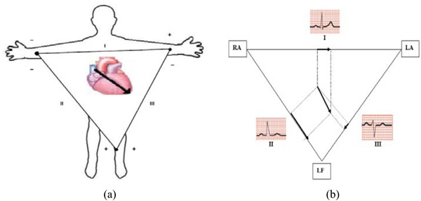 Automated Risk Identification Of Myocardial Infarction Using 600x287 Automated Risk Identification Of Myocardial Infarction Using