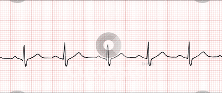 450x190 Electronic Cardiogram Illustration Stock Vector