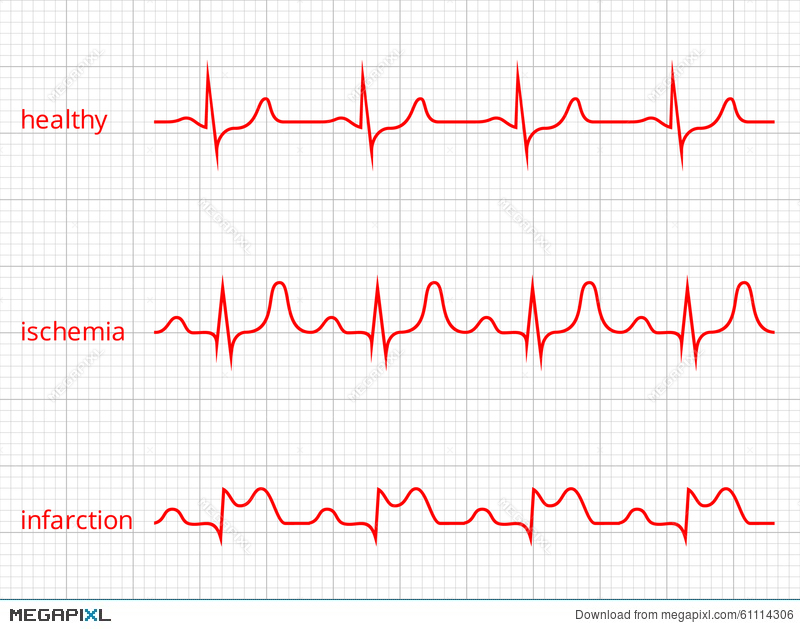 800x629 Heart Cardiogram Vector Charts Set Healthy Heart Illustration