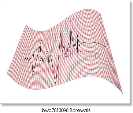 435x370 Heart Cardiogram