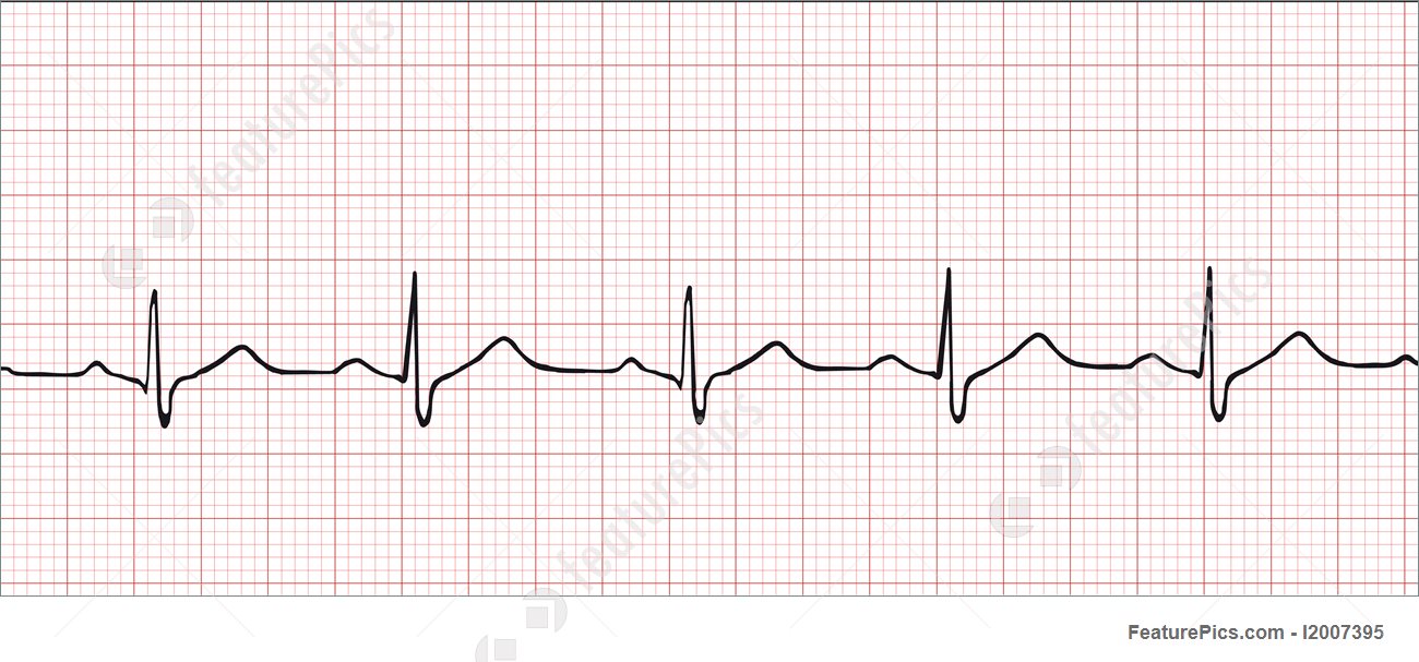 1300x607 Templates Electronic Cardiogram