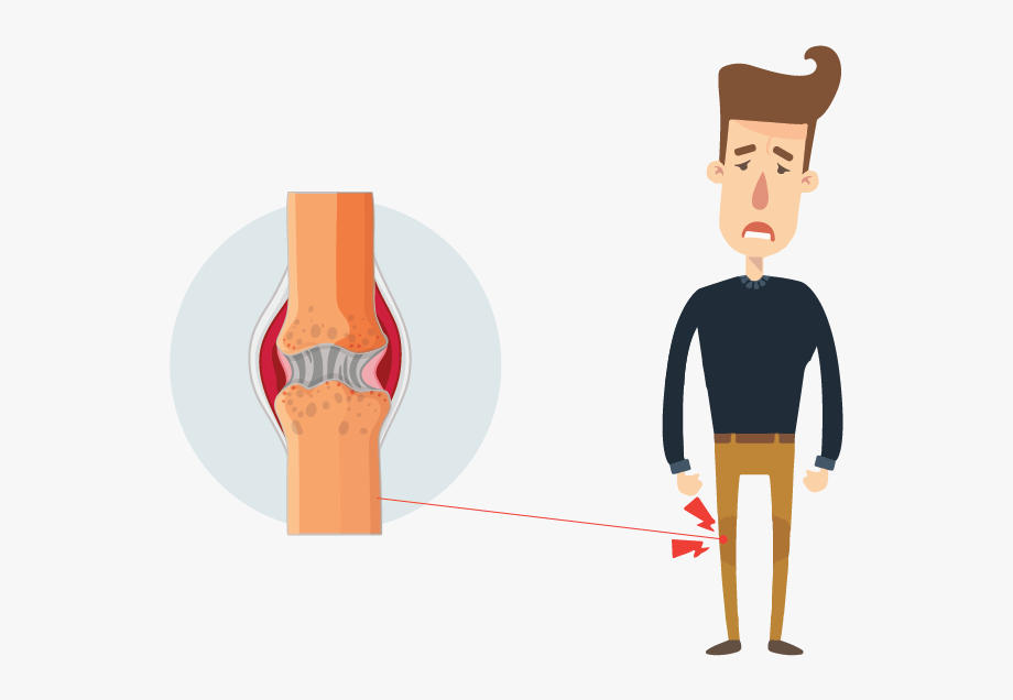 Body Parts Clipart Knee 920x636 Body Parts Clipart Knee