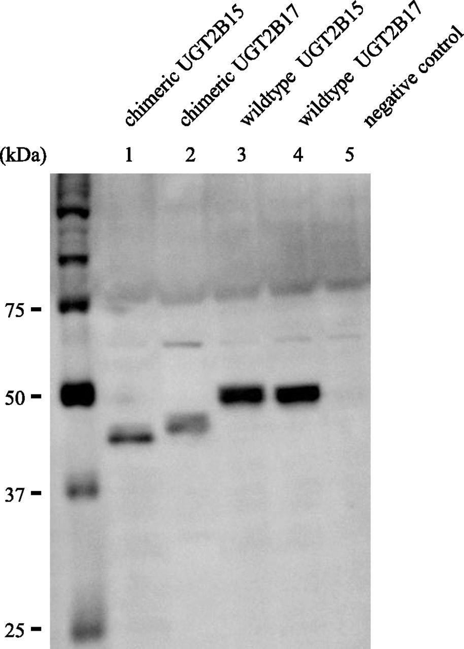 Intergenic Splicing Between Four Adjacent Ugt Genes 914x1280 Intergenic Splicing Between Four Adjacent Ugt Genes