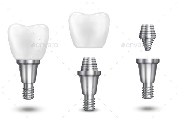 590x408 Tooth Implant Vector Illustration Fonts Logos Icons Teeth