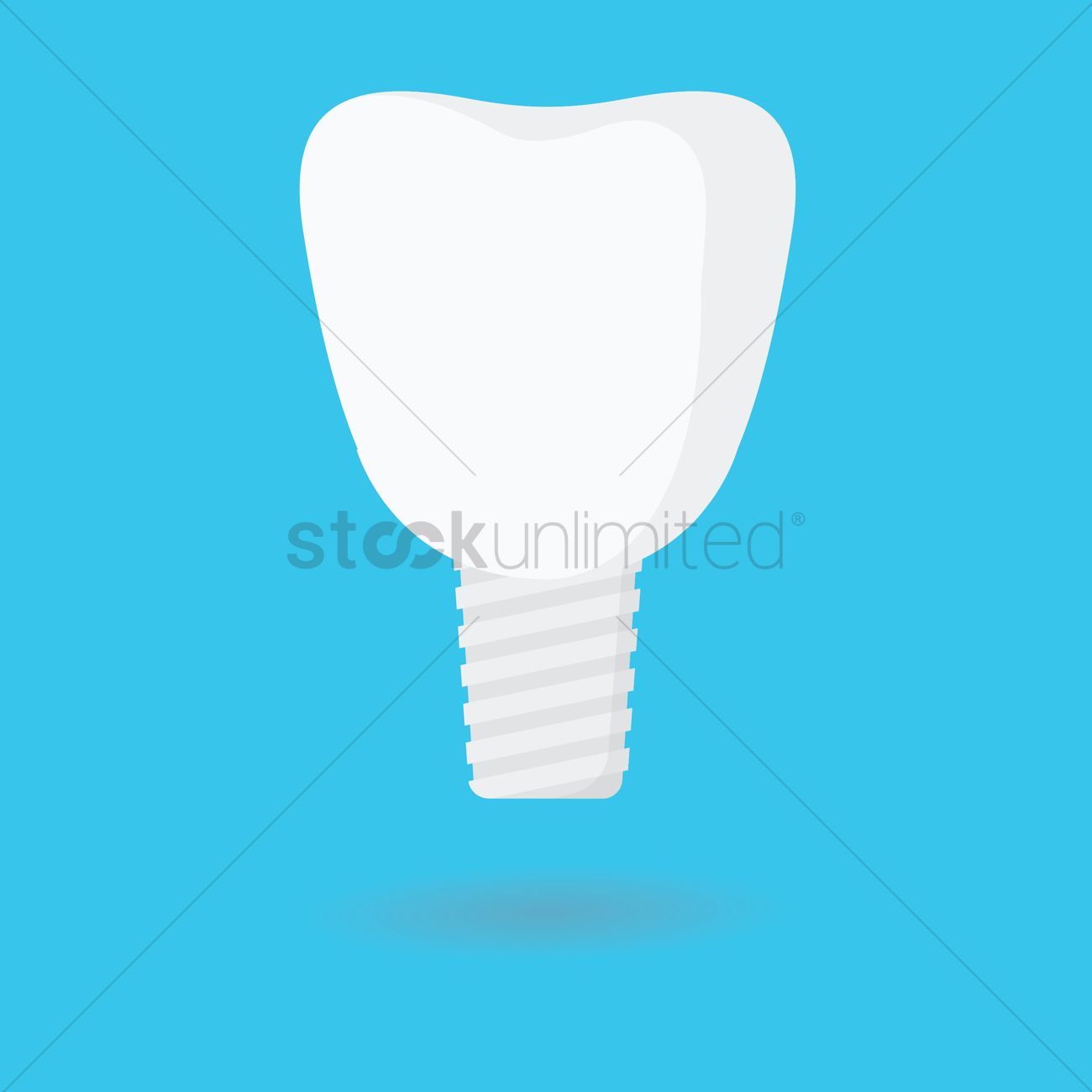 1300x1300 Dental Implant Vector Image