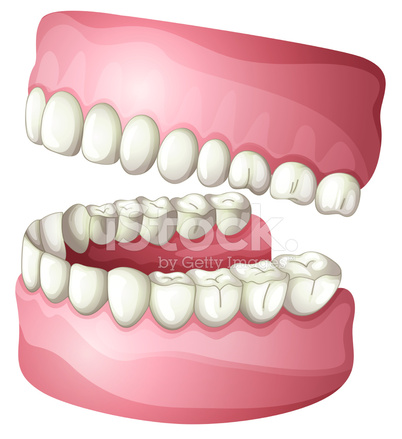 402x439 Denture Stock Vector