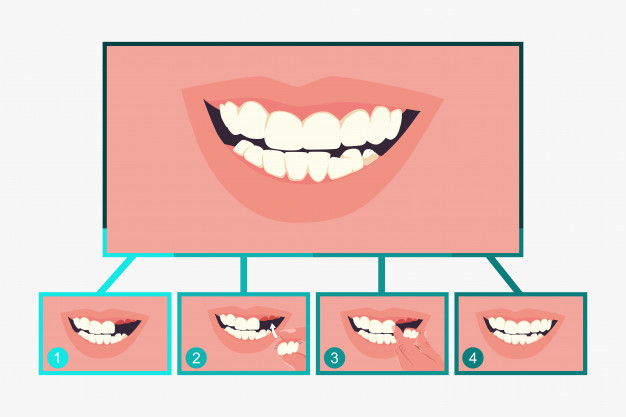 626x417 Partial Denture Dental Vector Premium Download