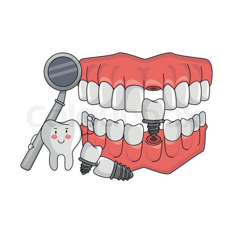 800x800 Tooth Fixing Denture With Dental Stock Vector Colourbox