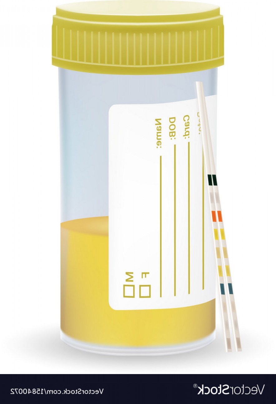 885x1296 Ph Test Strips Litmus Paper And Urine In Test Jar Vector Studiogrfx