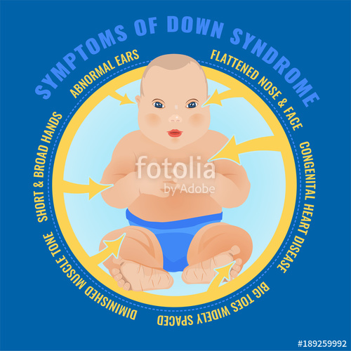 500x500 Down Syndrome Child Stock Image And Royalty Free Vector