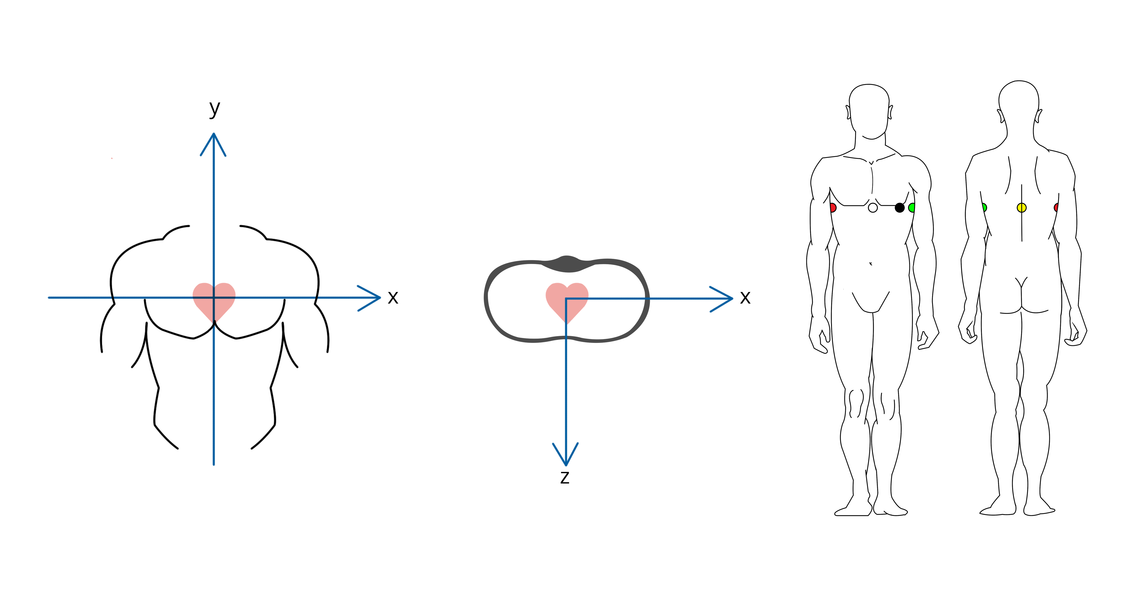 Lead Systems How An Ecg Works Cardiosecur 1140x604 Lead Systems How An Ecg Works Cardiosecur