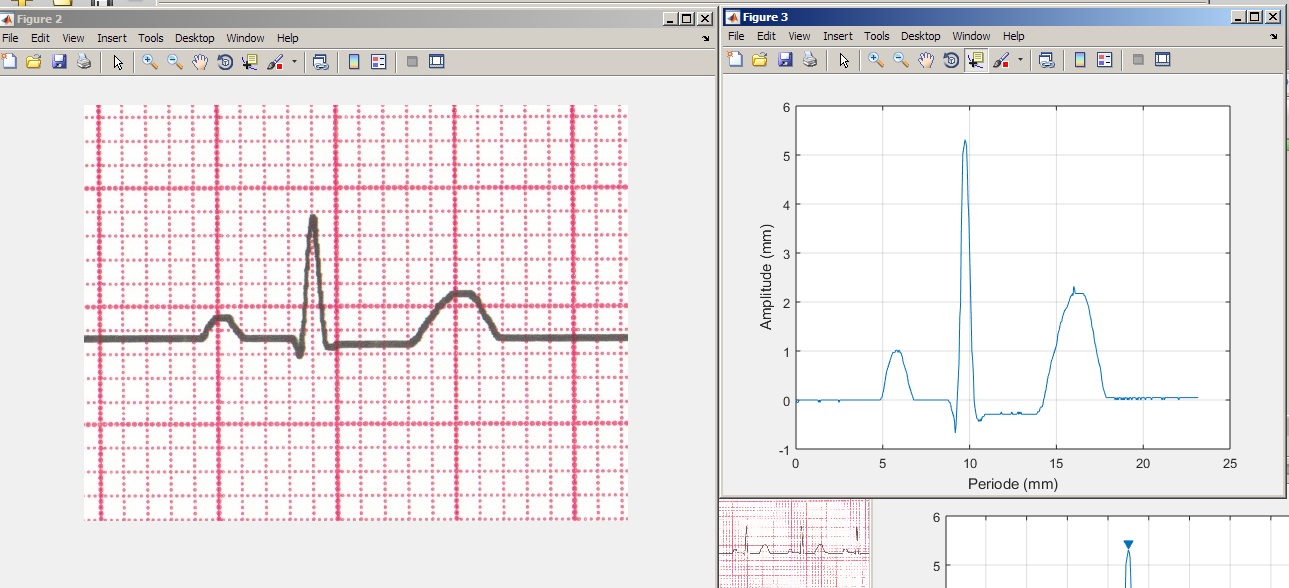 Ecg Paper Image To Vector 1289x588 Ecg Paper Image To Vector