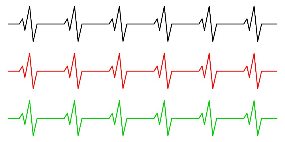 Bigstock Heart Rhythm Ecg Line Vector 1000x500 Bigstock Heart Rhythm Ecg Line Vector
