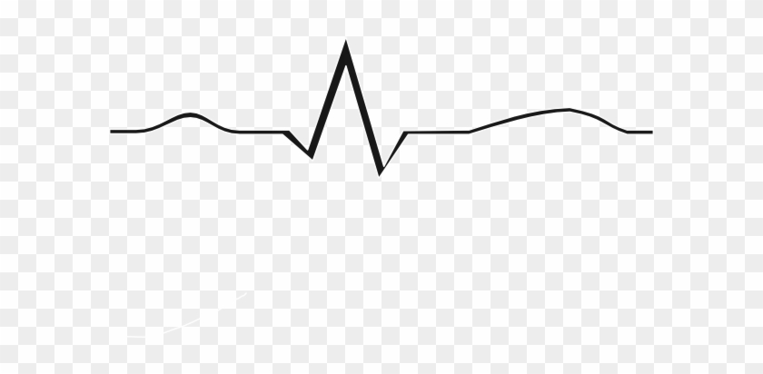Ekg Clip Art At Clker Com Vector Clip Art Online Royalty 840x412 Ekg Clip Art At Clker Com Vector Clip Art Online Royalty