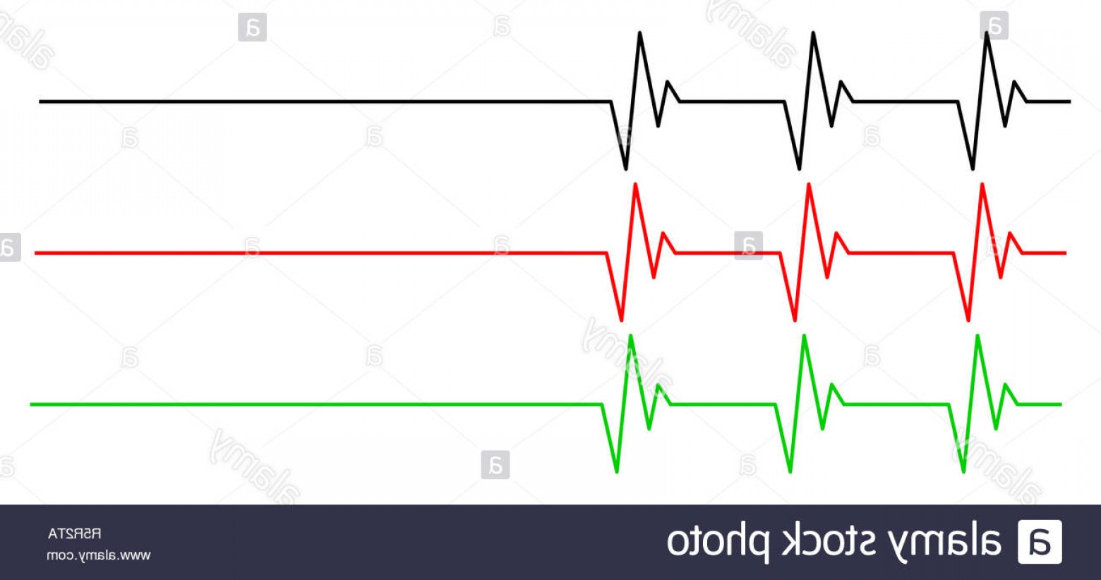 Ekg Vector