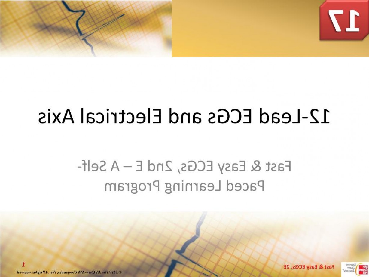 Lead Ecgs And Electrical Axis Soidergi 1228x921 Lead Ecgs And Electrical Axis Soidergi