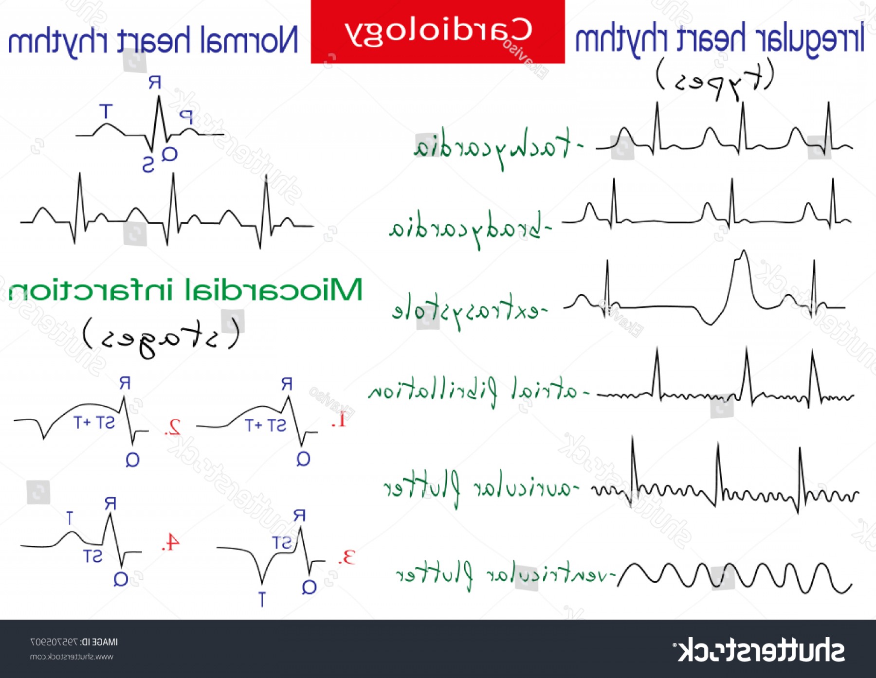 Normal Pathological Ecg Collection Shematic Vector Soidergi 1800x1394 Normal Pathological Ecg Collection Shematic Vector Soidergi