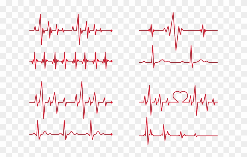 Rate Clipart Ekg 840x533 Rate Clipart Ekg
