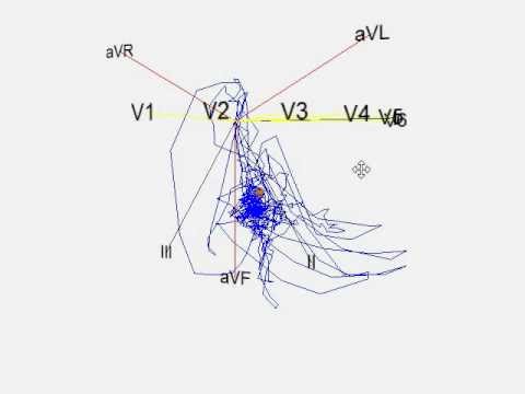 Vector Ekg 480x360 Vector Ekg