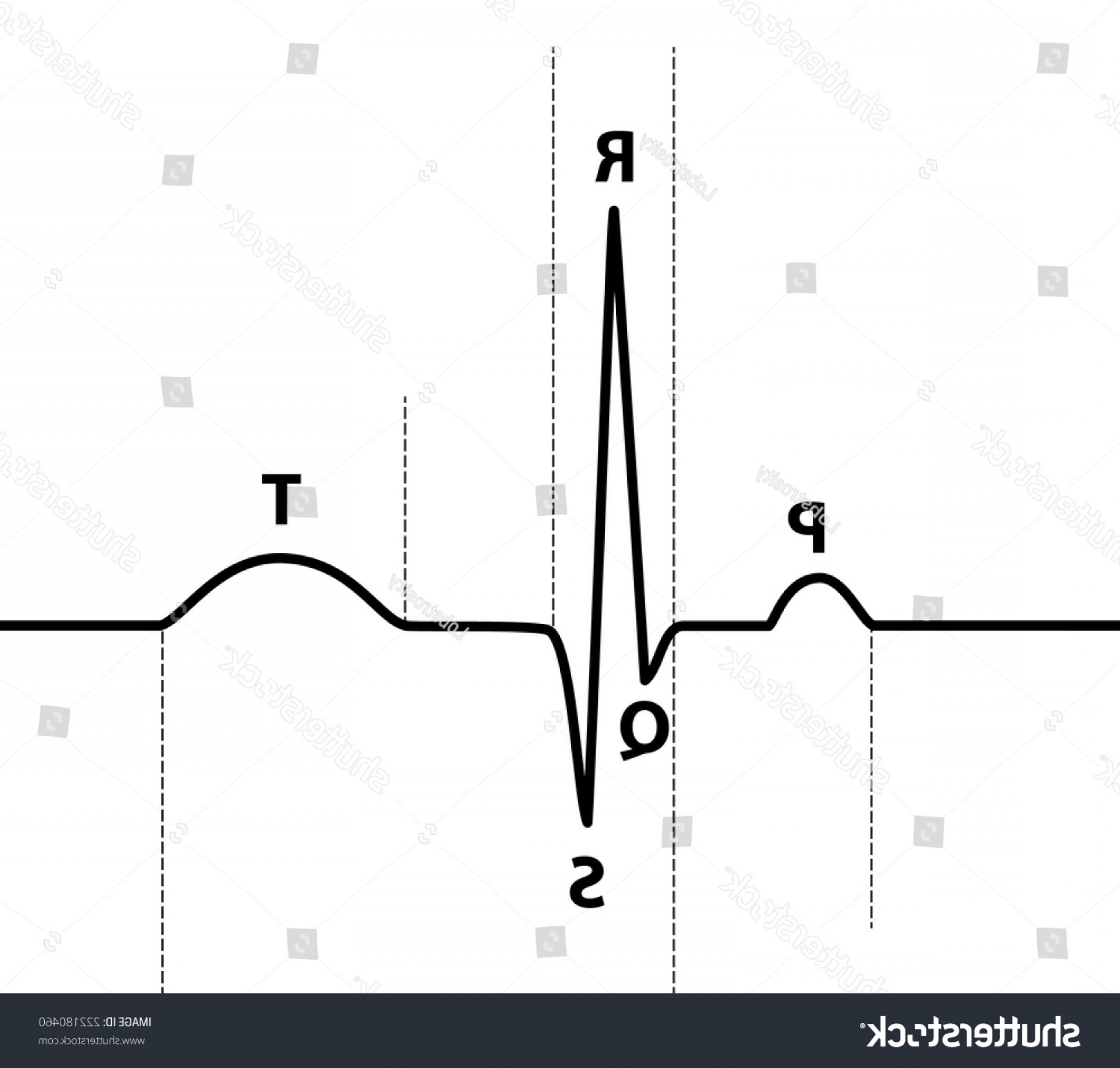 Waveform Ekg Vector Wallkeeper 1800x1717 Waveform Ekg Vector Wallkeeper