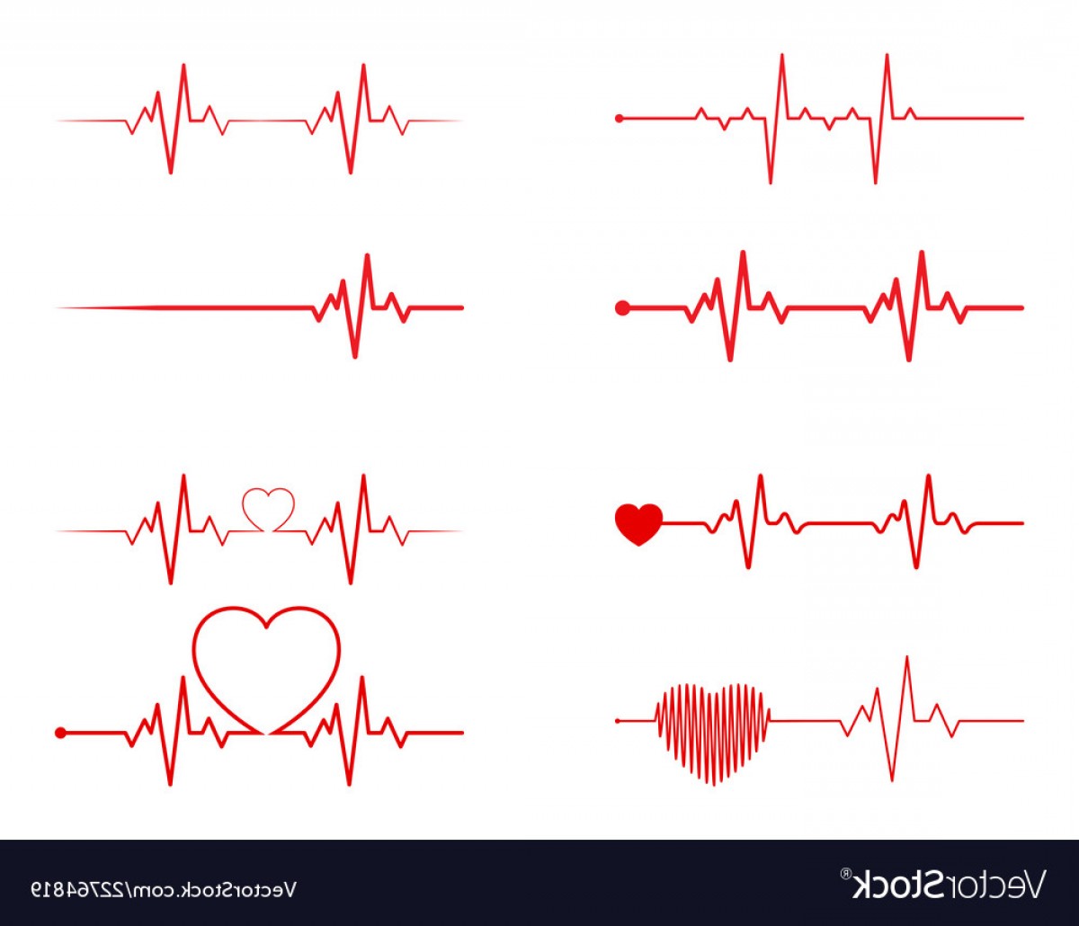 Cardiac Ekg Vector Cqrecords 1200x1030 Cardiac Ekg Vector Cqrecords