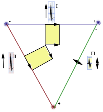 Cardiovascular Lab Electrocardiogram Basics 348x378 Cardiovascular Lab Electrocardiogram Basics
