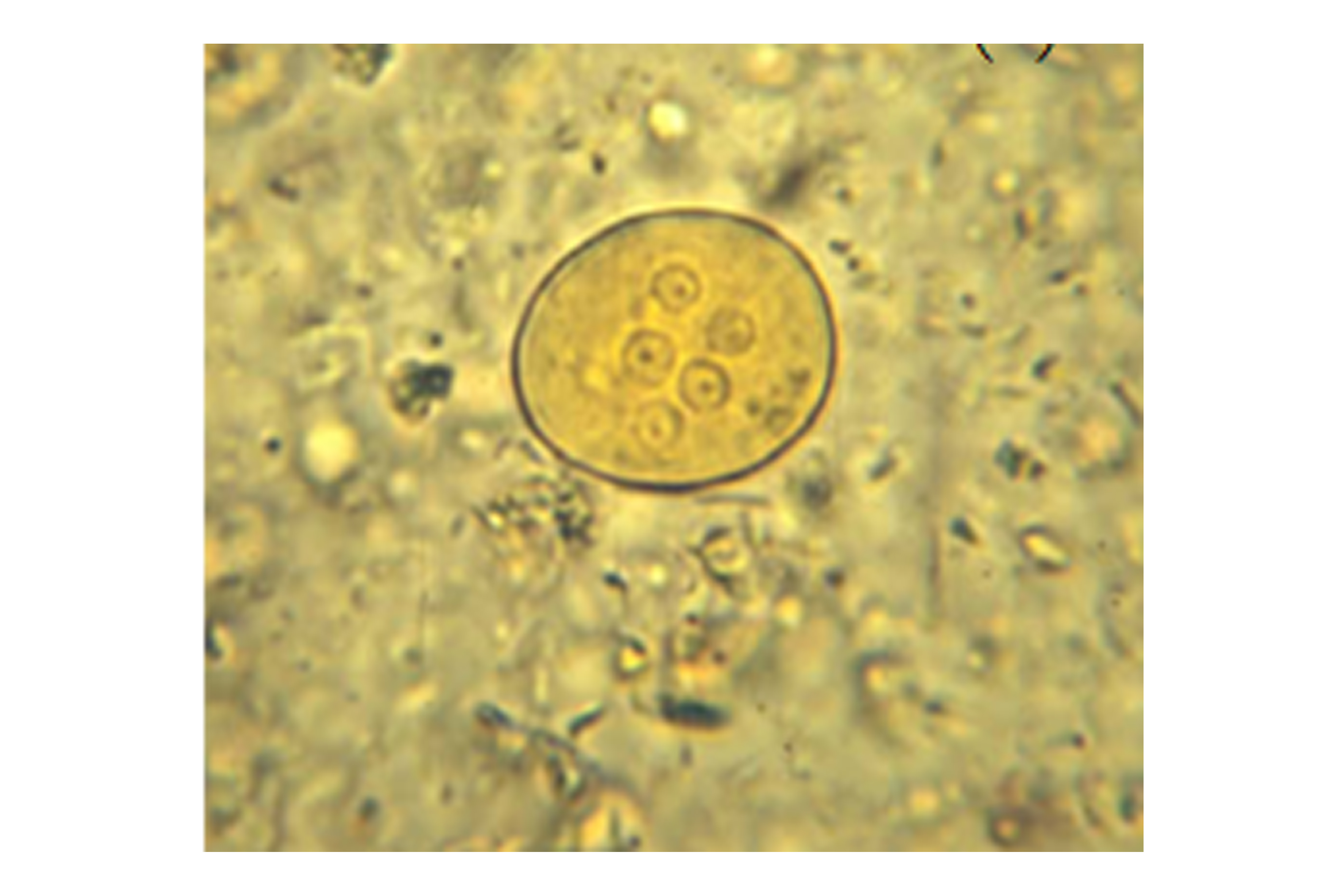 Entamoeba coli в кале. Цисты Endolimax Nana. Entamoeba histolytica. Entamoeba histolytica микроскопия. Entamoeba dispar цисты.