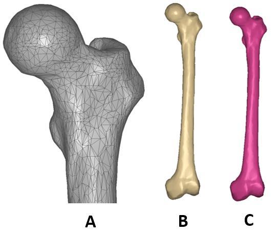 543x457 Reconstruction Of The Vector Surface Component Of The Left