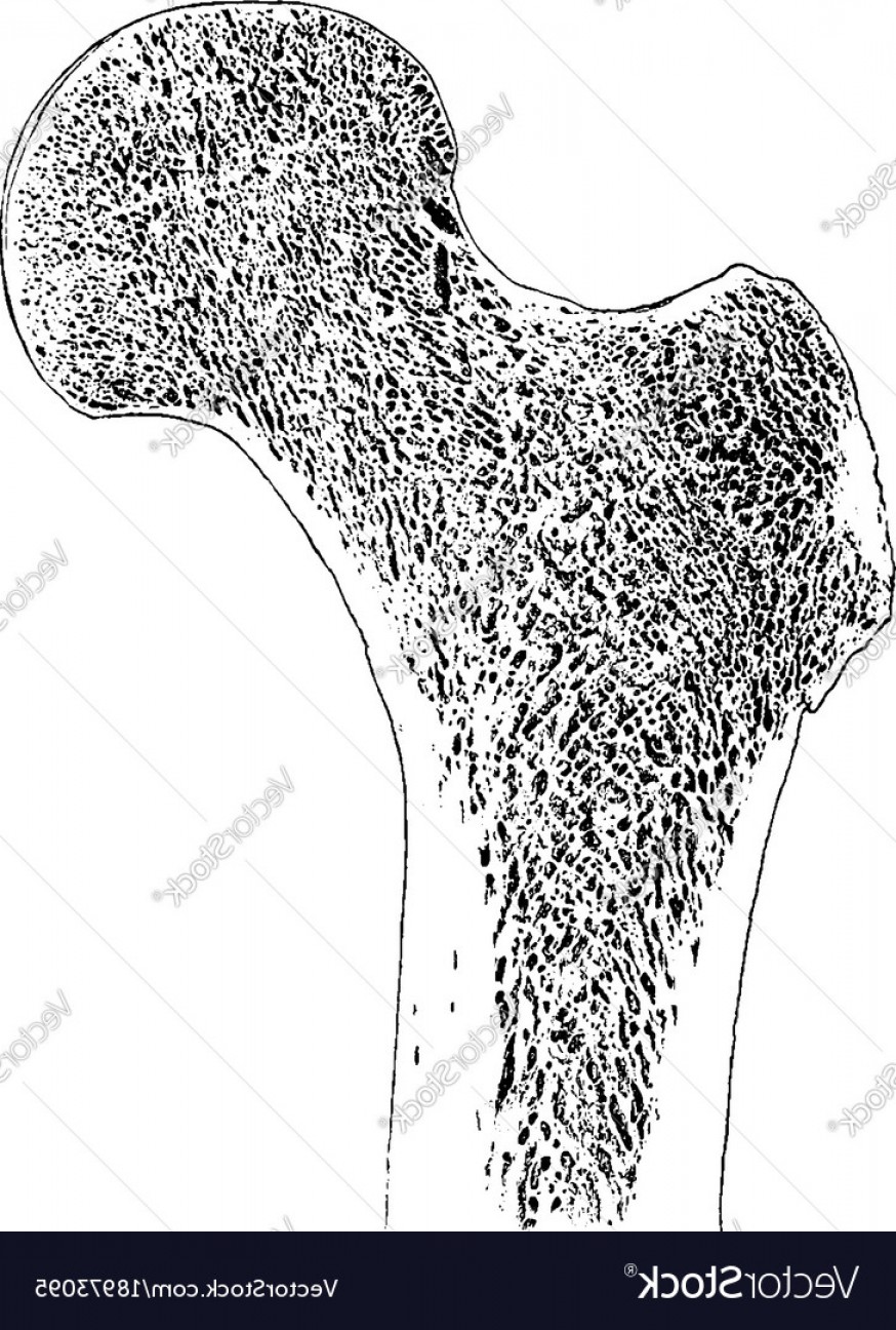 874x1296 Frontal Section Through Upper End Of Femur Vector Cqrecords