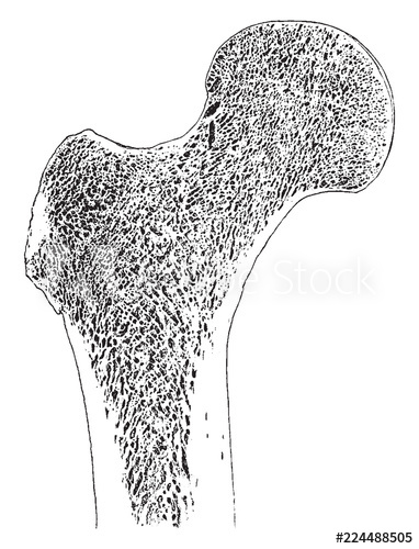 382x500 Frontal Section Through Upper End Of Femur, Vintage Illustration