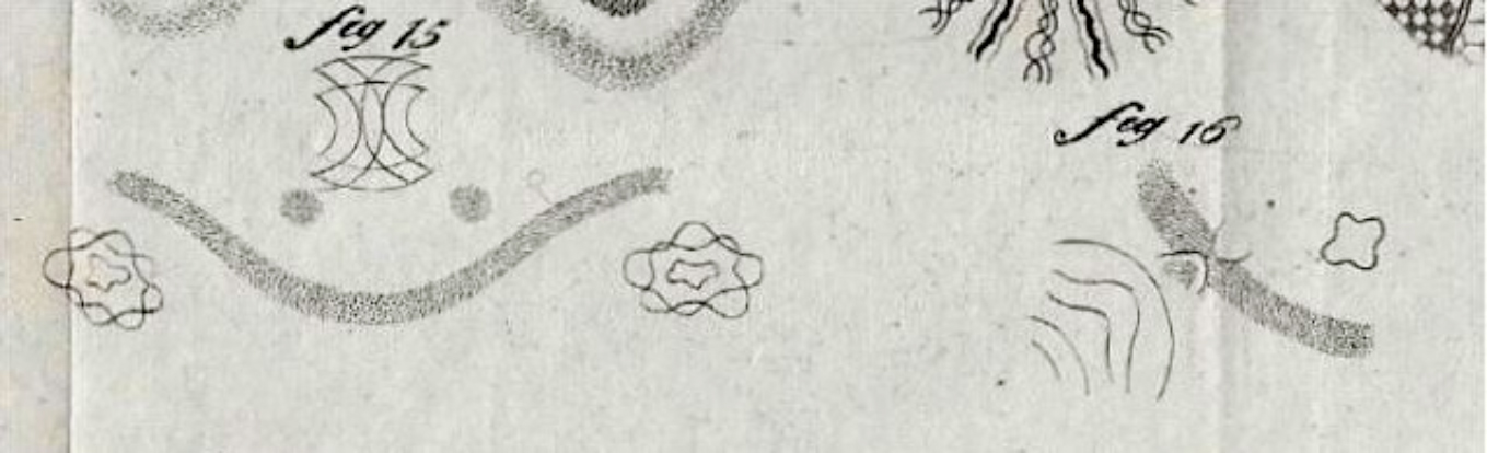 1359x414 Retinal Prostheses