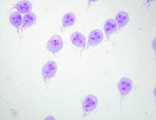 220x169 Giardia Lamblia
