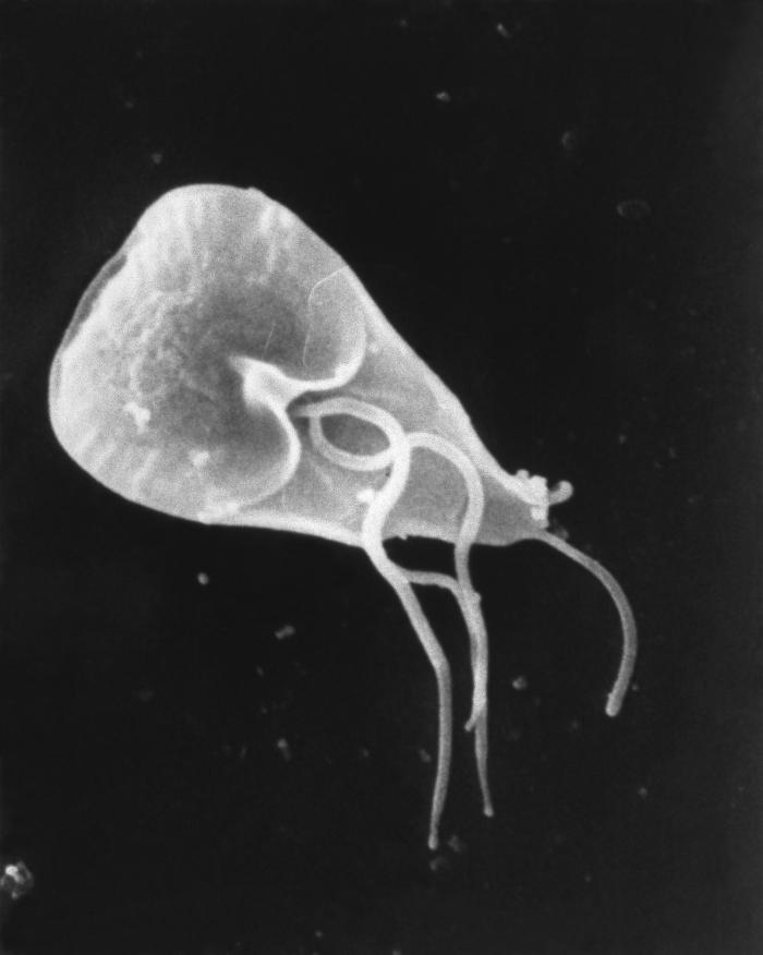 700x876 Giardiasis