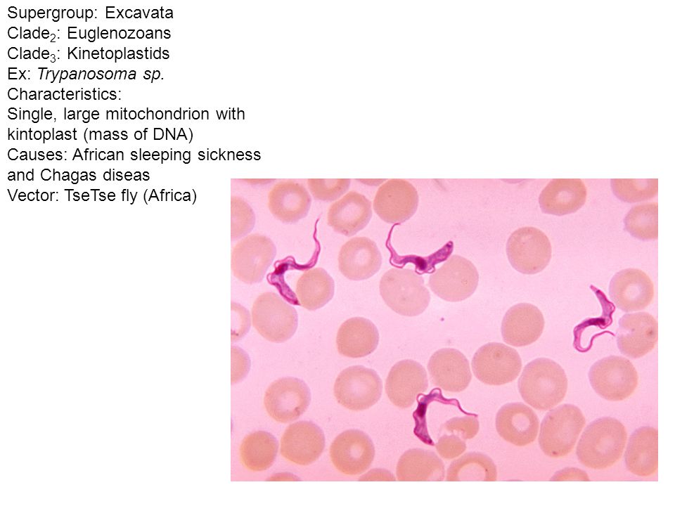 960x720 Supergroup Excavata Clade Diplomonads Ex Giardia Lamblia